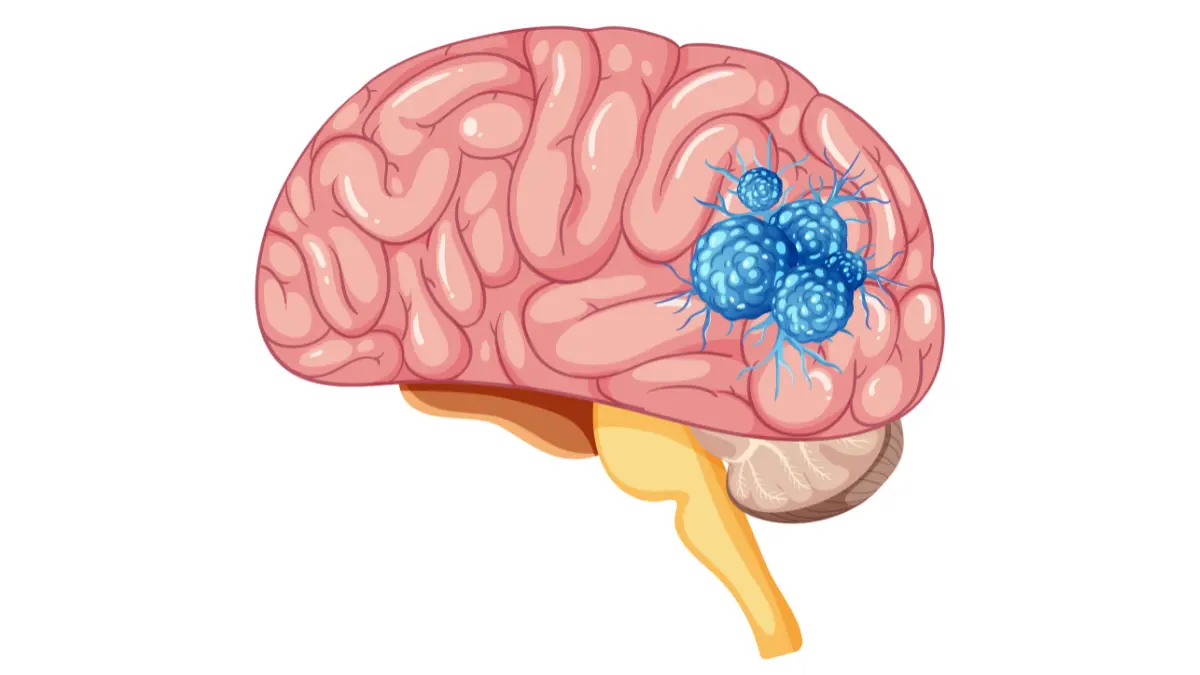 How to reduce anxiety — illustration showing amygdala, hypothalamus, and HPA axis releasing cortisol and adrenaline during stress response
