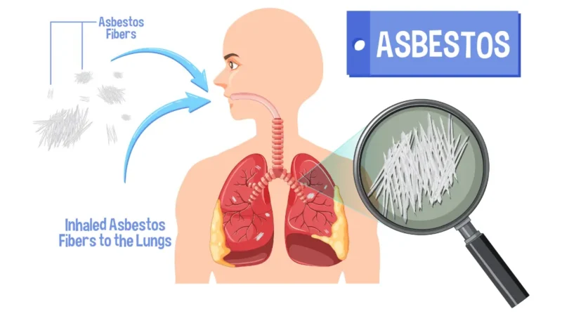 Medical illustration showing asbestos fibers causing mesothelioma cancer in lung tissue with cellular damage mechanism