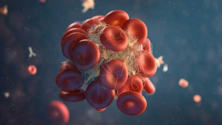 3D medical visualization of blood clots showing red blood cells trapped in a fibrin mesh