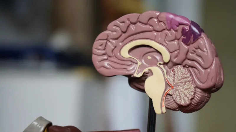 Brain Tumor anatomy showing sagittal brain cross-section and internal structures