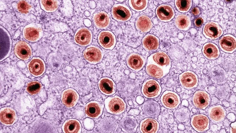 Electron microscopy image of cytomegalovirus particles used for CMV test research and diagnosis