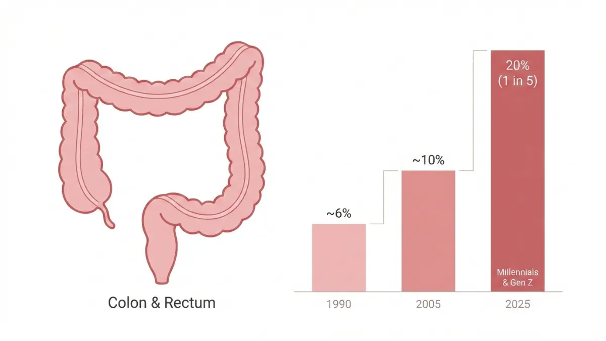 Medical anatomy infographic showing 1 in 5 colorectal cancer cases now occurring under age 50 with rising trend in younger adults