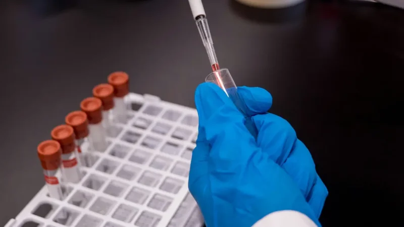 CRP Test blood sample collection and laboratory analysis