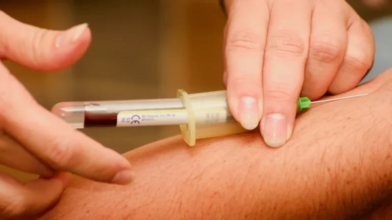 Anti-CCP Test laboratory procedure showing blood sample collection setup