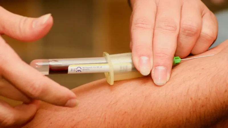 Anti-CCP Test laboratory procedure showing blood sample collection setup