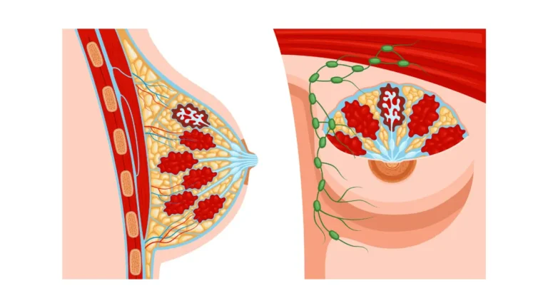 Medical illustration showing breast anatomy explaining why you cannot increase breast size naturally - labeled mammary glands, adipose tissue, lymph nodes, and pectoral muscle