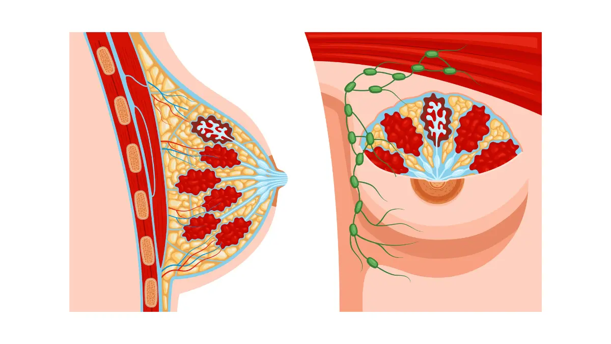 Medical illustration showing breast anatomy explaining why you cannot increase breast size naturally - labeled mammary glands, adipose tissue, lymph nodes, and pectoral muscle