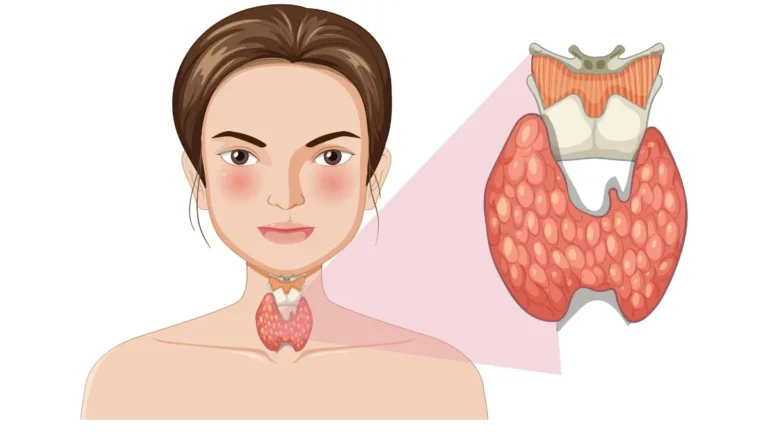 Thyroid gland anatomy diagram showing butterfly-shaped gland location in neck - understanding hypothyroidism symptoms starts with thyroid structure