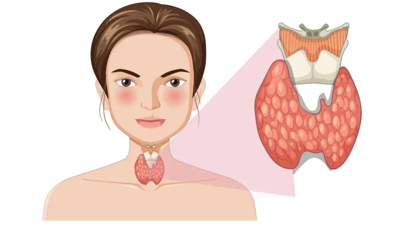 Thyroid gland anatomy diagram showing butterfly-shaped gland location in neck - understanding hypothyroidism symptoms starts with thyroid structure