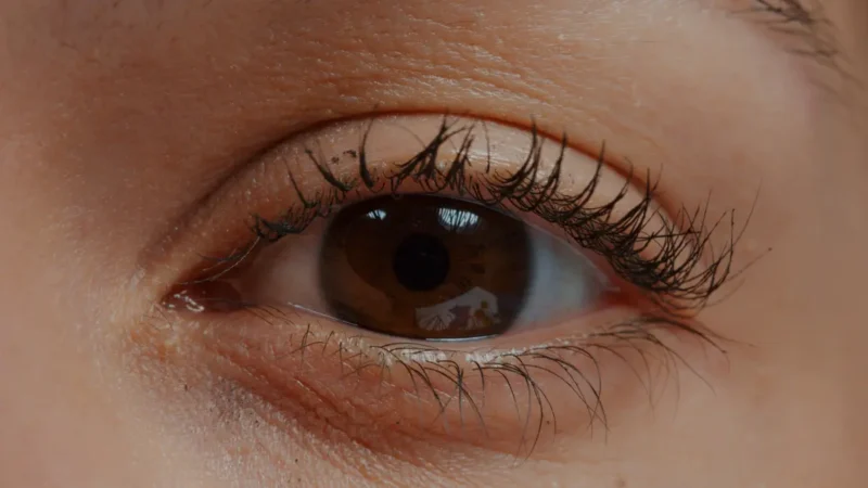 LASIK eye surgery close-up showing natural human eye before vision correction