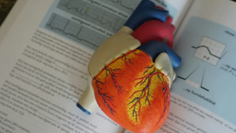 Myocardial infarction featured image with ECG diagrams and heart anatomy model on textbook