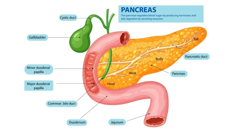 Pancreatic cancer symptoms illustrated on detailed pancreas anatomy showing ducts, head, body, and tail