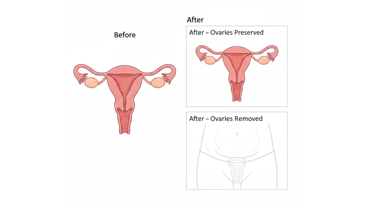 Hysterectomy medical anatomy vector illustration before and after reproductive system removal