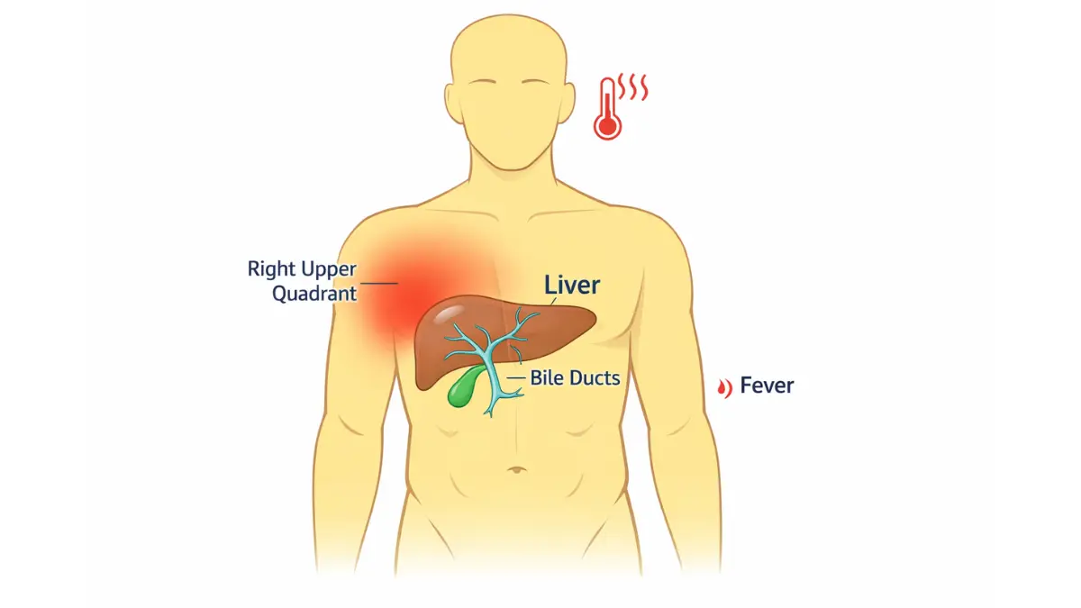 Human torso diagram showing right upper quadrant pain, jaundice and fever symptoms for EMG Results visualization