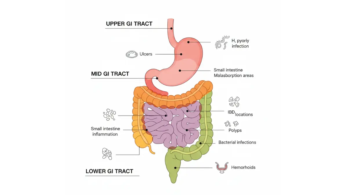 Digestive system anatomy diagram showing conditions detected by Stool Report including ulcers, IBD, polyps, and infections
