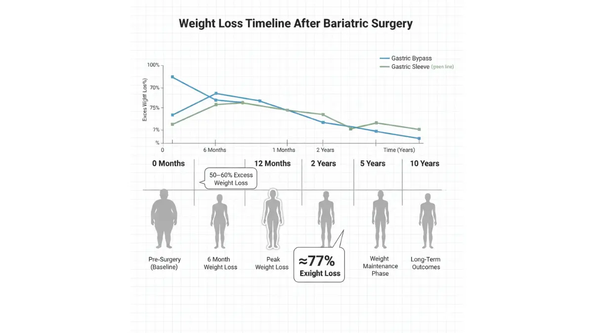 Bariatric surgery weight loss timeline infographic showing 77 percent excess weight loss at 12 months and long-term results