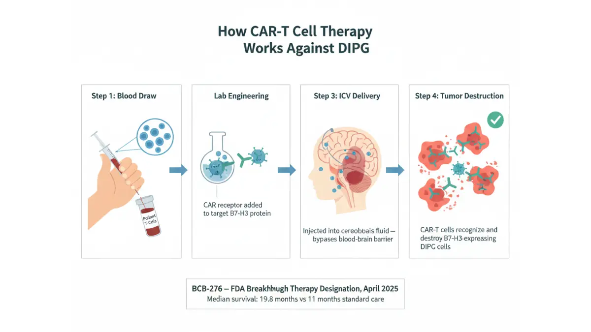 Step-by-step medical diagram showing how BCB-276 CAR-T cell therapy targets DIPG tumor cells through intracerebroventricular brainstem delivery