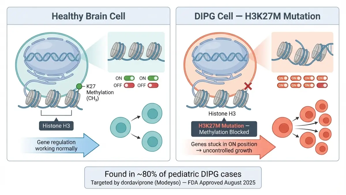 Medical diagram comparing normal histone methylation with H3K27M mutation in DIPG pediatric brain tumor cells showing uncontrolled gene activation