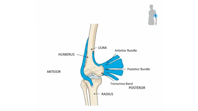 UCL Tear anatomy diagram showing ulnar collateral ligament location in elbow joint with labeled humerus ulna radius and ligament bundles
