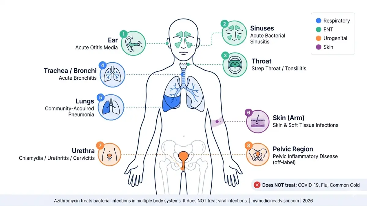 Azithromycin full body infection map showing bacterial infection sites including lungs sinuses throat ear skin and urogenital tract