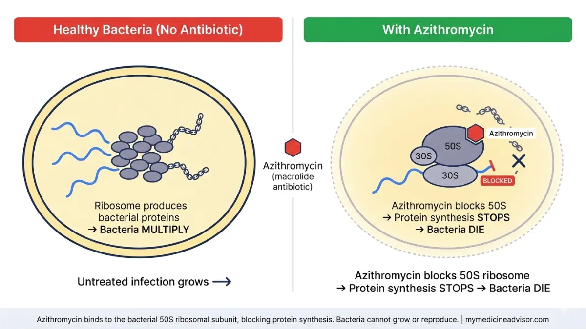 Azithromycin mechanism of action diagram showing how it blocks the bacterial 50S ribosomal subunit to stop protein synthesis and kill bacteria