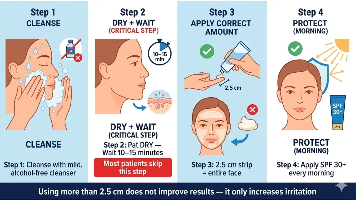 Skinoren application steps infographic showing cleansing drying skin correct amount of cream and sunscreen protection