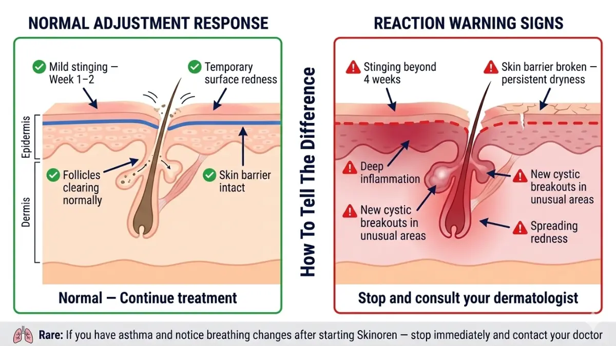 Skinoren normal reaction vs adverse reaction medical diagram showing skin redness barrier damage and inflammation