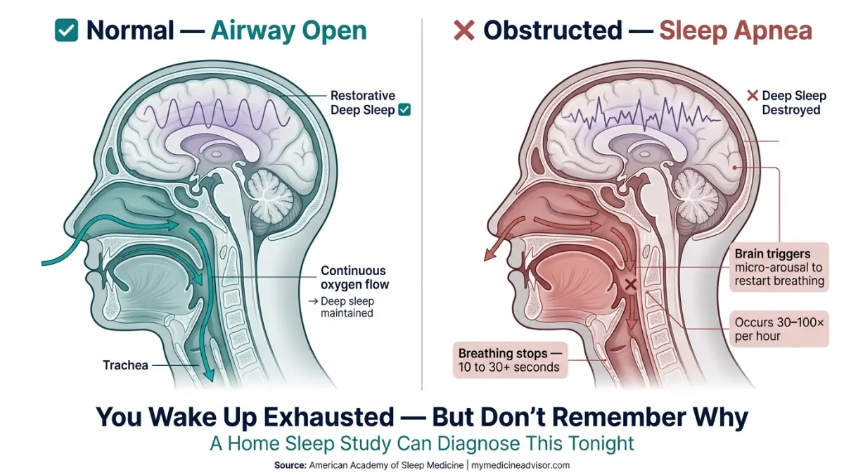 sleep apnea anatomy diagram comparing normal airway and obstructed airway during sleep showing tongue blockage and airflow disruption