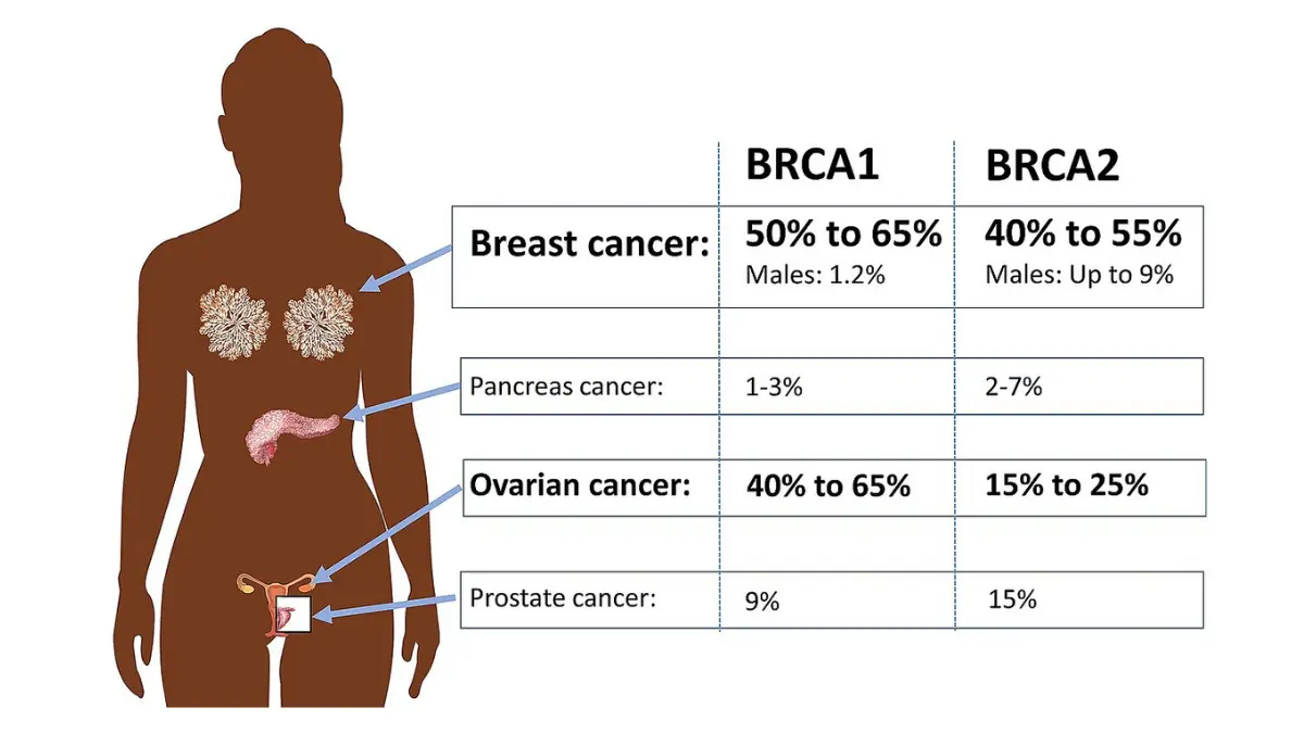 BRCA1 and BRCA2 gene mutation chart showing absolute cancer risk percentages — hereditary genetic mutations that causes lung cancer and other cancers by age 70 — 2026 updated data