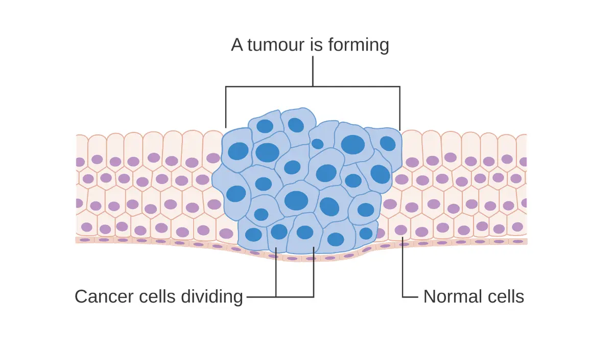 CRUK diagram showing abnormal cancer cells reproducing uncontrollably to form a malignant tumor — illustrates how smoking, radon gas, and air pollution exposure triggers tumor development as a sign of lung cancer risk in both smokers and non-smokers