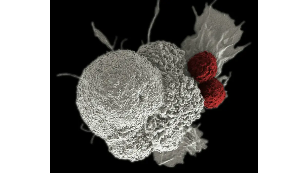 Scanning electron microscope image of cytotoxic T cells attacking a cancer cell — the immune mechanism powering breakthrough melanoma clinical trials in 2026 including CAR-T and checkpoint inhibitor studies