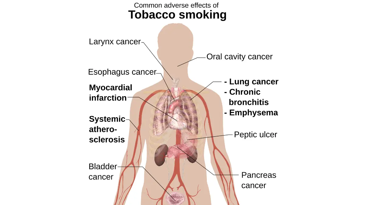 Lung cancer statistics 2026 — medical body diagram showing adverse health effects of tobacco smoking including lung cancer as the leading smoking-related cancer