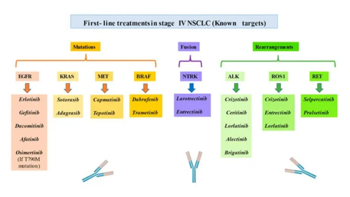 Diagram showing non-small cell lung cancer subtypes including peripheral adenocarcinoma — the most common lung cancer subtype responsible for unique lung cancer symptoms in women