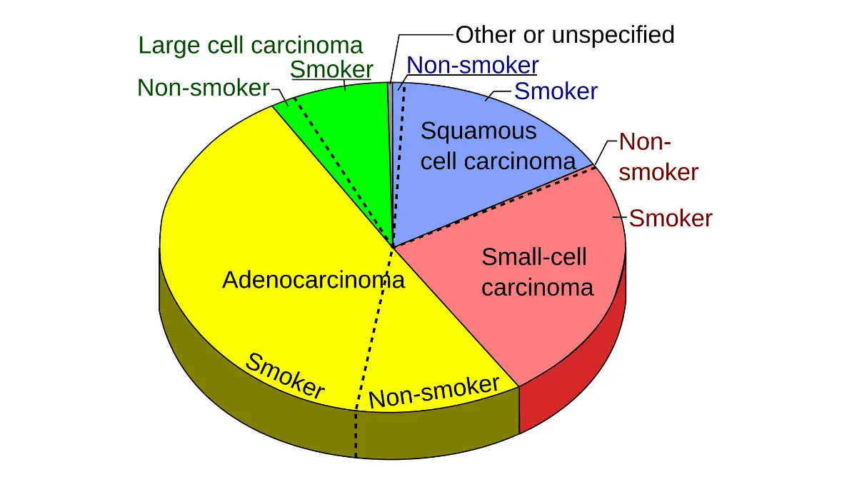 Pie chart showing lung cancer types and prevalence including adenocarcinoma, squamous cell carcinoma, large cell carcinoma, and small cell lung cancer