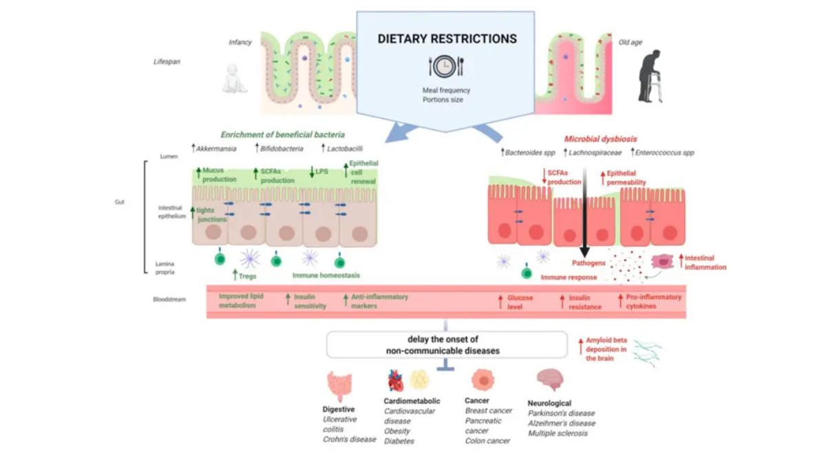 Scientific peer-reviewed diagram showing the role of gut microbiota in dietary restrictions and gut barrier function relevant to melanoma diet and immunotherapy treatment outcomes for skin cancer patients