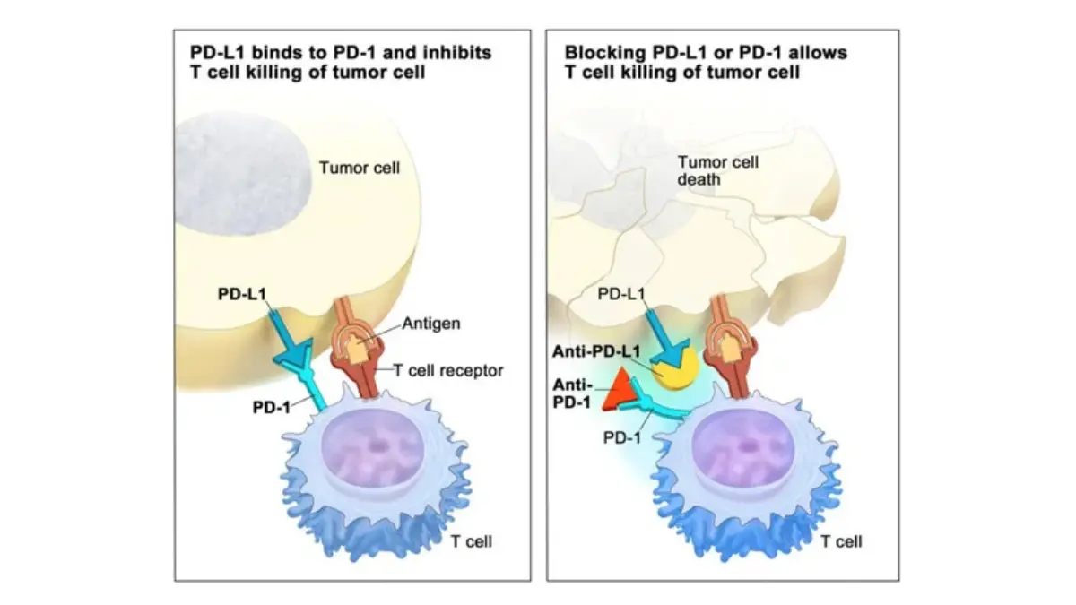Scientific schematic showing how immune checkpoint inhibitors PD-1 CTLA-4 work in melanoma immunotherapy treatment and how melanoma diet and gut microbiome directly affect T-cell activation and treatment response