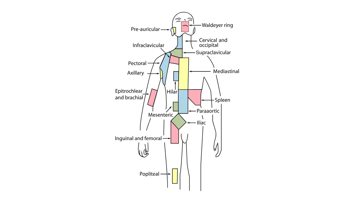 Anatomy diagram showing major lymph node regions throughout the human body including cervical axillary and inguinal nodes which are the primary sites of regional melanoma recurrence after treatment