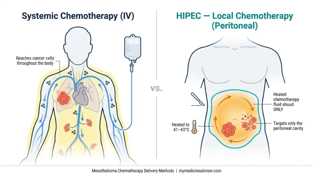 Mesothelioma Chemotherapy comparison showing systemic IV chemotherapy versus HIPEC localized peritoneal treatment differences