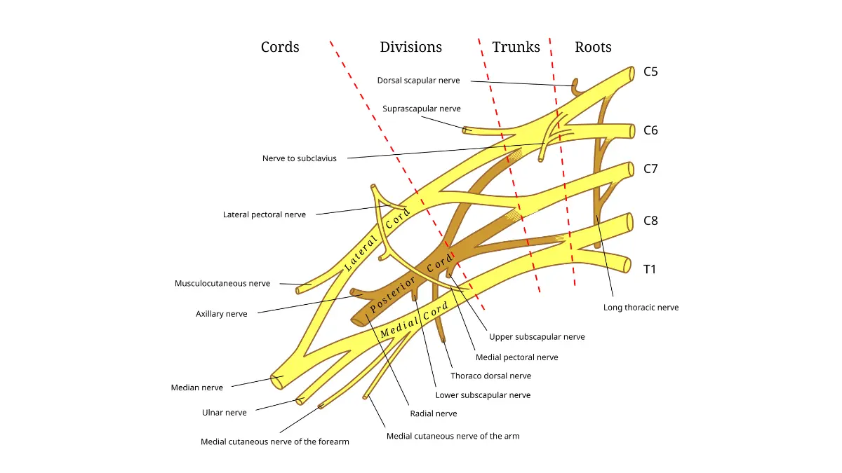 Anterior view labeled anatomy diagram of the right brachial plexus nerve roots showing how Pancoast lung tumors compress nerves to cause lung cancer back pain and shoulder pain
