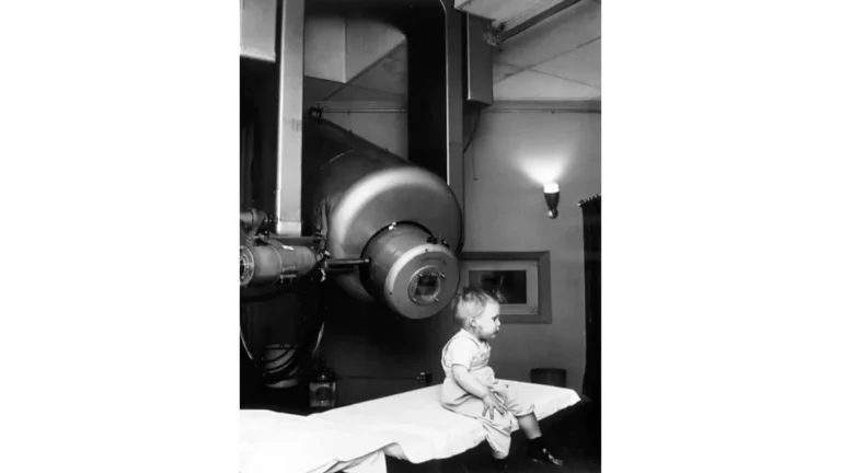 radiation therapy for melanoma using external beam LINAC machine — patient receiving cancer treatment