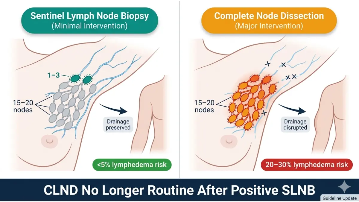 Sentinel Lymph Node Biopsy vs complete lymph node dissection diagram showing lymphatic anatomy and lymphedema risk