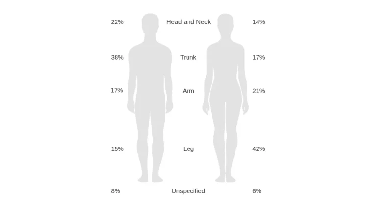 Stage 4 melanoma diagram showing common metastatic spread sites on human body including back legs face and neck where melanoma most commonly develops before becoming metastatic