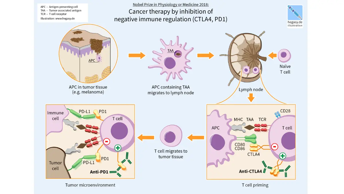 Stage 4 melanoma checkpoint inhibitor mechanism showing how ipilimumab blocks CTLA-4 and nivolumab or pembrolizumab blocks PD-1 to remove immune suppression and allow activated T cells to identify and destroy metastatic melanoma tumor cells