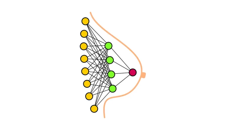 Annotated medical vector diagram of breast lobules, ducts, and lymphatic architecture for Breast Cancer During Pregnancy clinical evaluation and patient education.