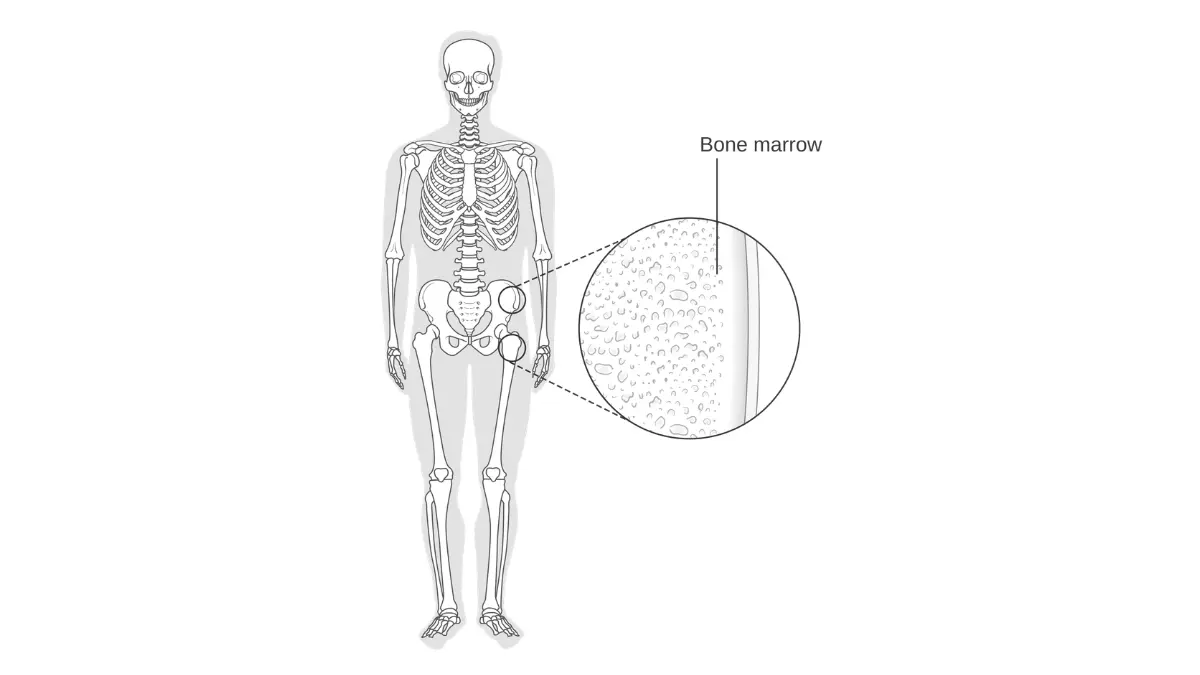 Bone marrow diagram showing blood cell production affected by breast cancer chemotherapy myelosuppression.