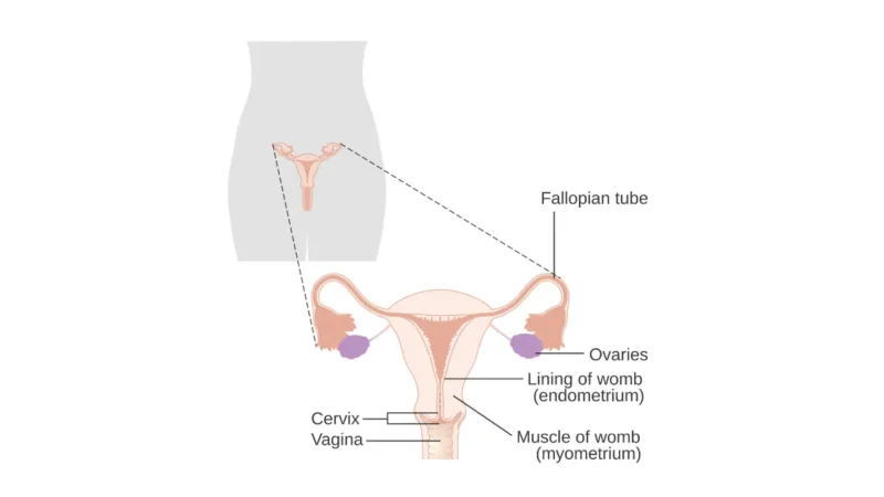 Breast cancer fertility preservation diagram showing the female reproductive system, including the ovaries, fallopian tubes, uterus, cervix, and vagina.