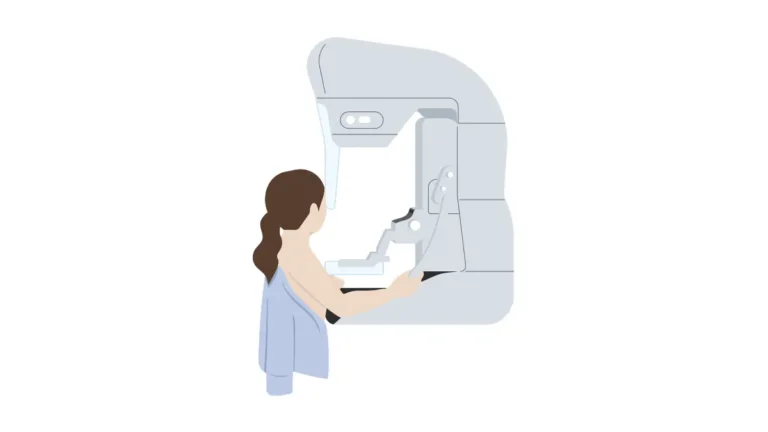 breast cancer mammogram screening procedure illustration showing modern mammography imaging process