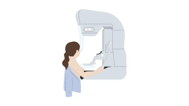 breast cancer mammogram screening procedure illustration showing modern mammography imaging process