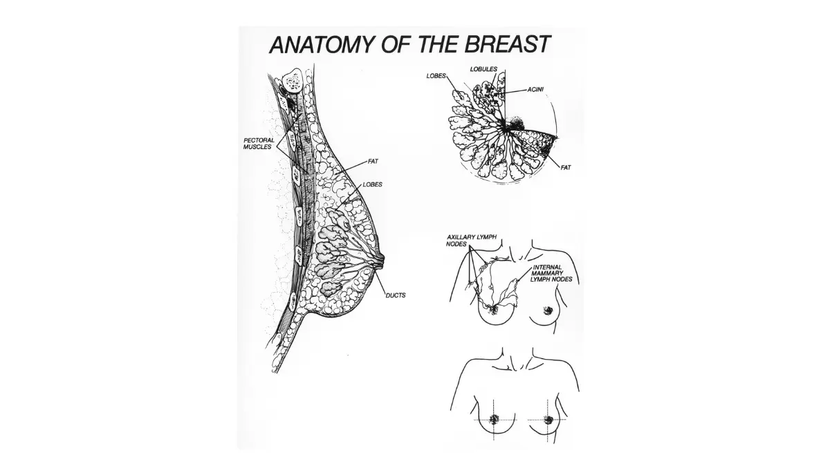Breast cancer educational anatomy plate showing multiple breast structure views