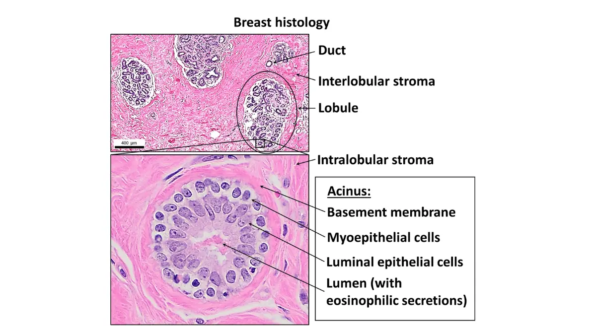 Breast cancer prevention normal breast histology illustration showing healthy breast tissue structure at the microscopic level.